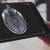 Close-up of a tablet screen with medical imagery on it.
