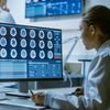 A woman in a doctor's coat looking at brain image scans.